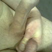 ----