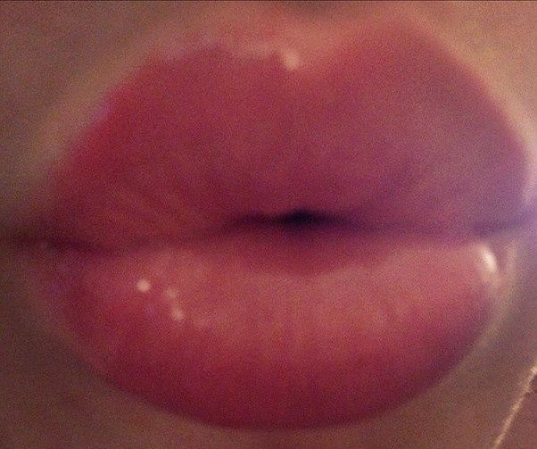 Kiss)