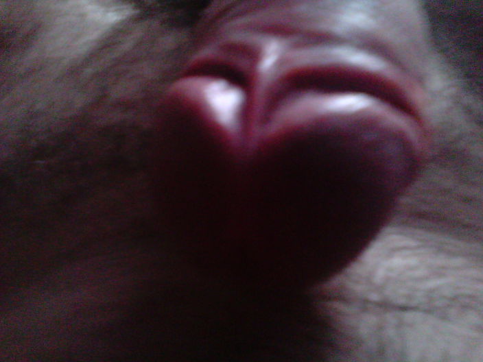 ****