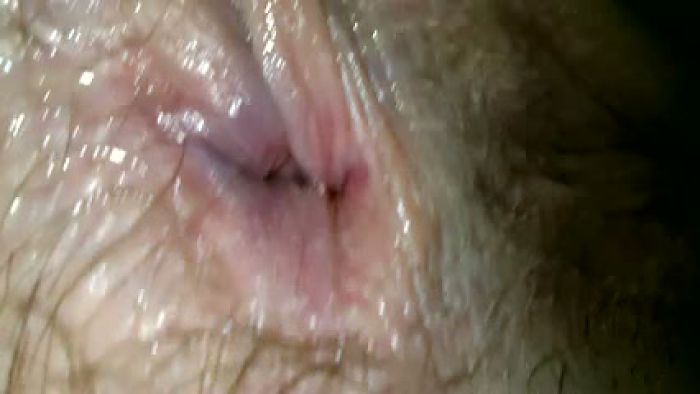 Прочистка анальных отверстий 3