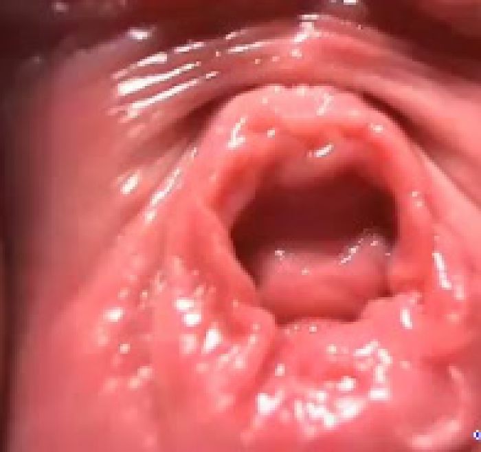 БЛЯЦКИЙ ПОТРОХ